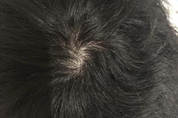 紫薇斗数发旋