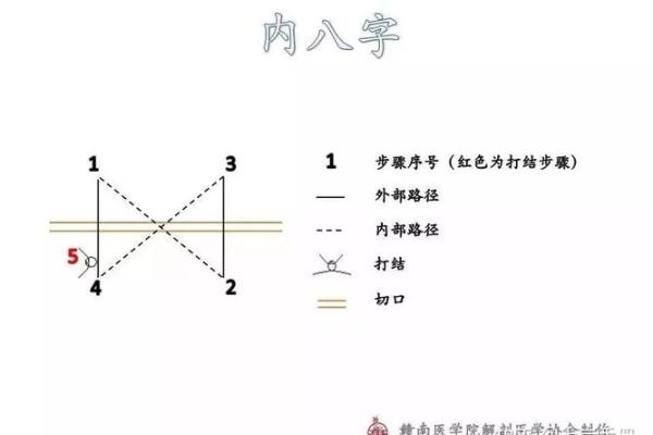 八字缝合
