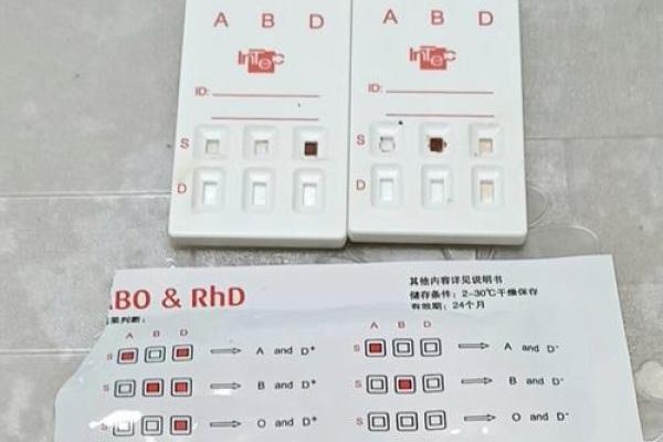 怎么知道自己是什么血型