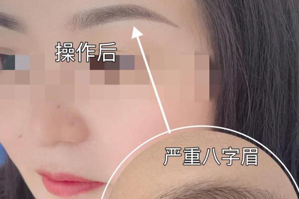 八字眉的女人命苦吗会有哪些问题