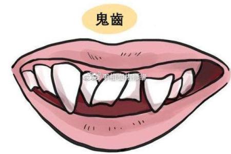 牙齿算命 有鬼牙不吉利吗