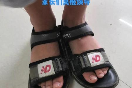 小儿内八字