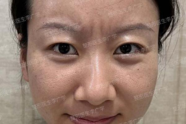 双雀纹与八字纹的区别是什么