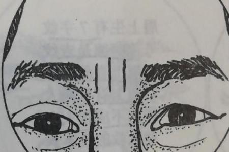 印堂八字纹的男人财运好吗