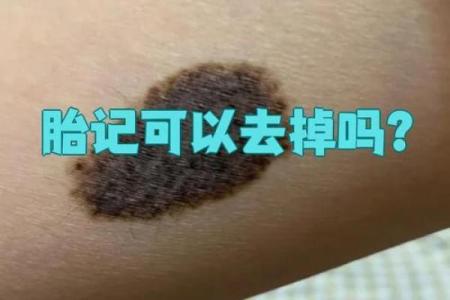 腿上不同位置的胎记算命