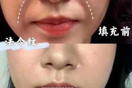 脸上八字