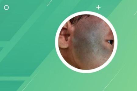 脸的各部位胎记算命详解